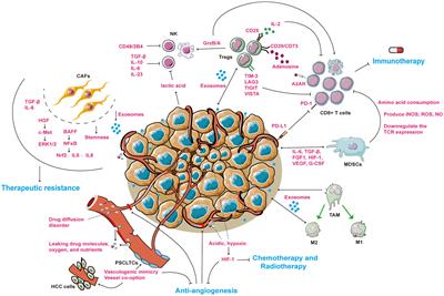 Overcoming the therapeutic resistance of hepatomas by targeting the tumor microenvironment